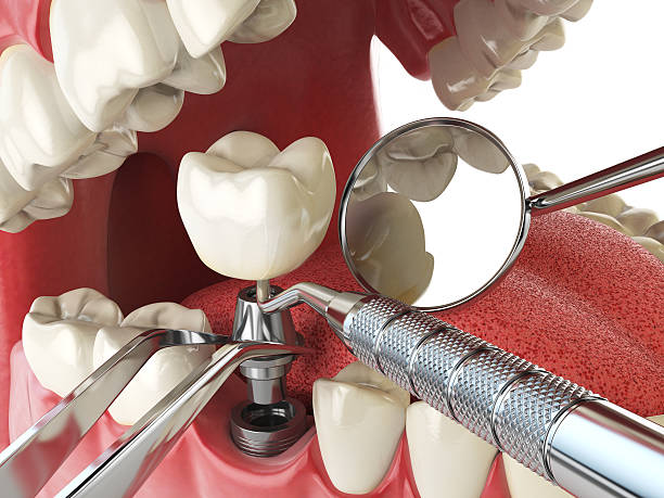 Best Emergency Treatment for Oral Infections in Spring Valley, AZ